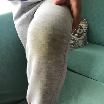 Perwoll İle Yıkanan Kıyafetlerde Lekeler Çıkmıyor, Hatta Kararıyor