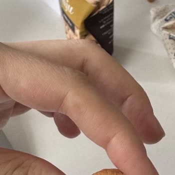 Çerezya Kajunun İçinden Kurt Çıkması Ve Hijyen Sorunu