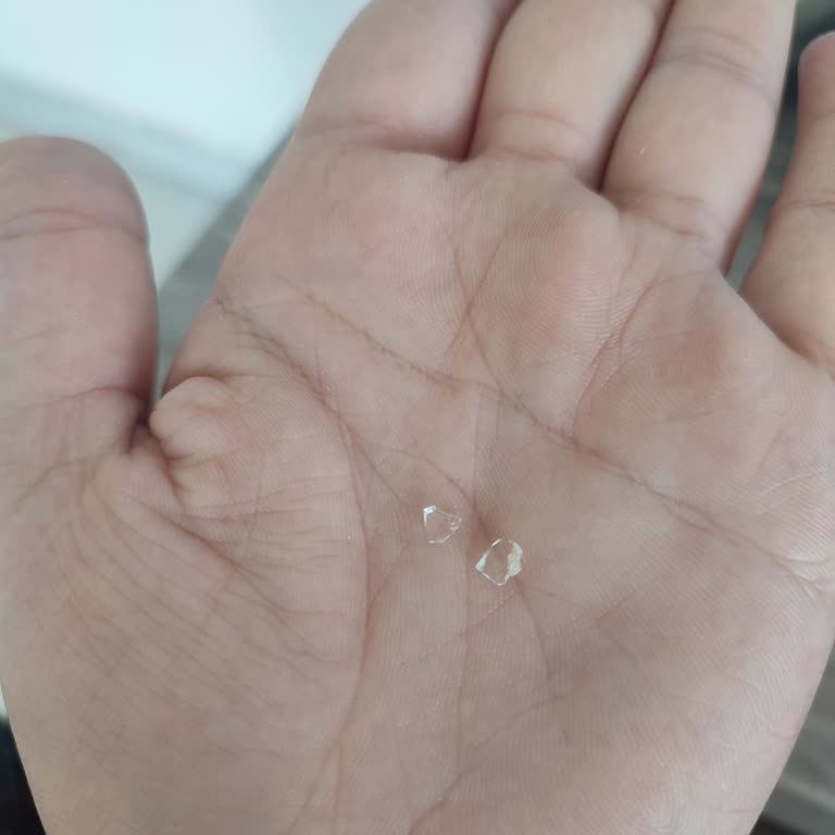 Fıstık Ezmesinden Çıkan Cam Parçaları Büyük Tehlike