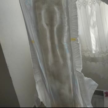 Molfix 5 Numara Bebek Bezi Sızıntı Sorunu Ve Kalite Hayal Kırıklığı