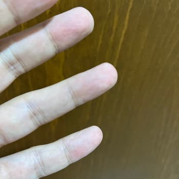 Drops Gıda'dan Patlamış Portakal Suyu Şişeleriyle Gelen Siparişim!