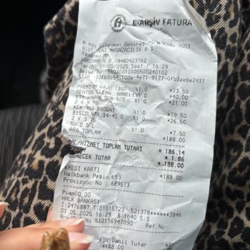 Aldığım Kaju Paketinden Yabancı Madde Çıktı, Kalite Kontrol Eksikliği Endişesi