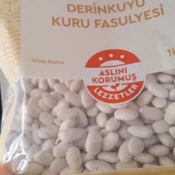 Hasata Kuru Fasulye Filizlendi, Müşteri Hizmetleri Sorunumu Çözmedi