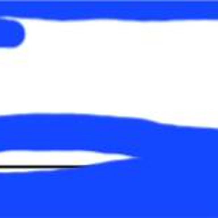 Akbank Kredi Kartı Üyelik Ücreti İadesinde Yetersiz Çözüm Ve Müşteri Hizmetlerinde İlgisizlik