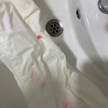 Beyaz Pantolonum Çamaşır Suyu İle Pembe Lekelendi Mağduriyet Yaşadım