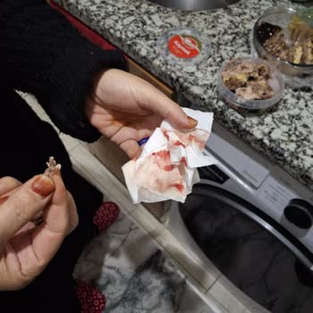 Pastadan Cam Parçası Çıktı, Annem Yaralandı!