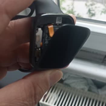 Akıllı Saatte Tekrarlayan Ekran Sorunu Ve Yetersiz Teknik Servis Deneyimi