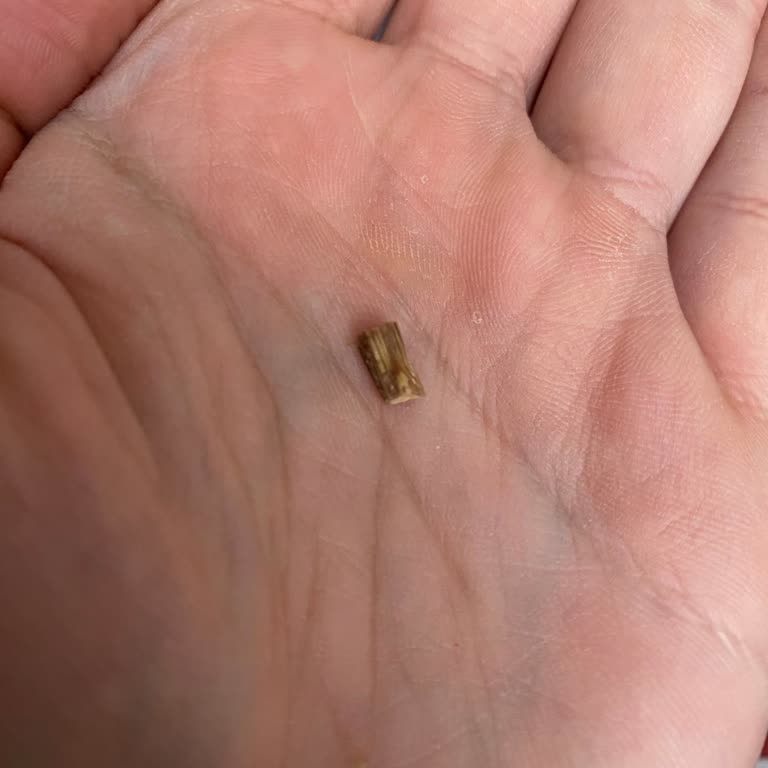 Baklavadan Çıkan Yabancı Cisimle Hayal Kırıklığı