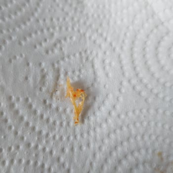 Superfresh Ton Balığı Ürününde Yabancı Madde Sorunu Ve Mağduriyet