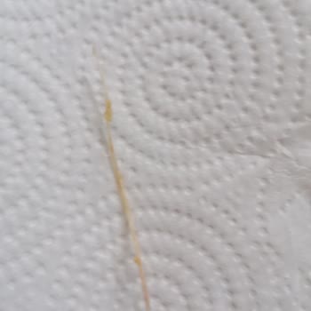 Ton Balığında Plastik Parçası Şoku: Sağlığımız Tehlikede