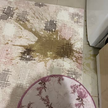 Keramika Fincanının Altı Çıktı, Yanık Ve Mağduriyet Yaşadım