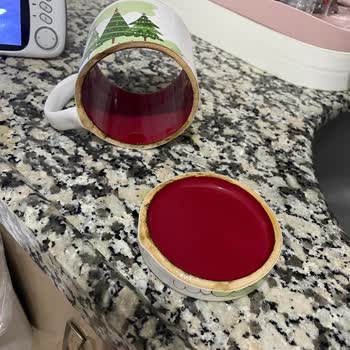 Keramika Fincanının Altı Çıktı, Yanık Ve Mağduriyet Yaşadım