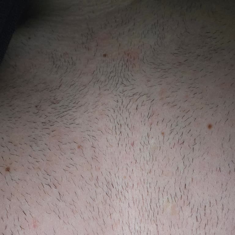 Ürün Beklenen Sonuçları Vermedi Ve Ciltte Tahrişe Neden Oldu