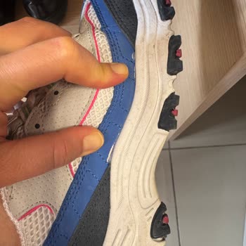 Aldığım Skechers Ayakkabı Kısa Sürede Açıldı, Garanti Destek Vermedi