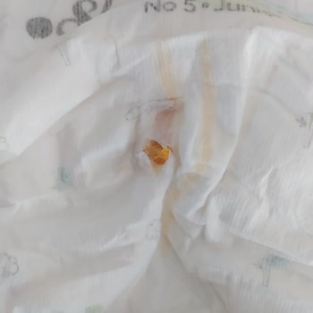 Bebek Bezinde Yabancı Cisim Şoku Organik Diye Aldık Fiyasko Çıktı