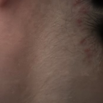 Afrika Örgü Bahçelievler Mağdur Oldum