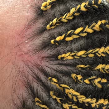 Afrika Örgü Bahçelievler Mağdur Oldum