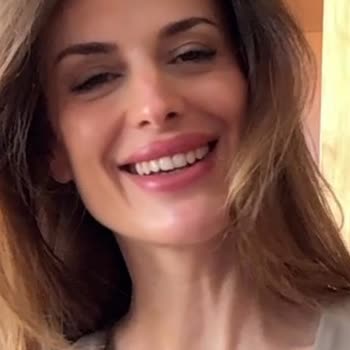 Yanlış Botoks Uygulaması Sonrası Yüz İfadem Kayboldu, Çözüm Sunulmadı