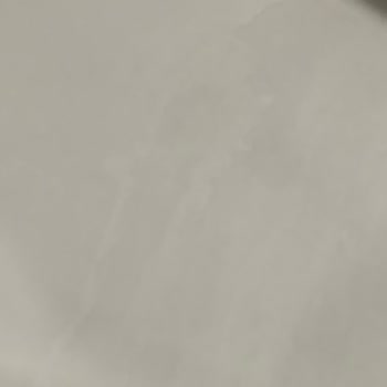 Vitra Bataryalarda Hızlı Renk Solması Ve Yetersiz Servis Desteği