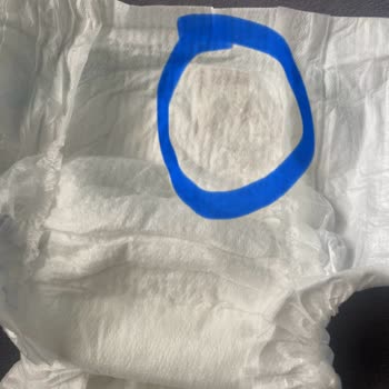 Molfix Premium Bezde Çocuğuma Zarar Verebilecek Üretim Hatası