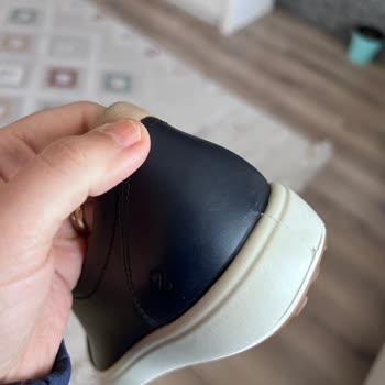 İndirimli Üründe Kusur Ve Müşteri Memnuniyetsizliği