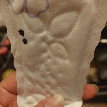 Molped Günlük Pedde Siyah Noktalar Nedeniyle Kullanamama Sorunu