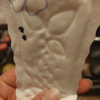 Molped Günlük Pedde Siyah Noktalar Nedeniyle Kullanamama Sorunu