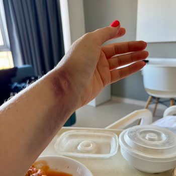 Hastanede Travmatik Ameliyat Ve İletişim Sorunları