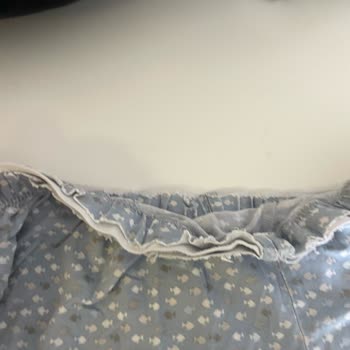 Kurutma Makinesi Kıyafetleri Parçalıyor Servis Çözüm Sunmuyor