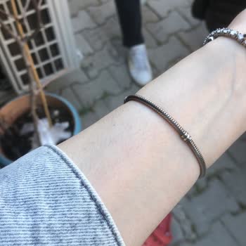 Pandora Bileklik 3 Günde Karardı Personel İlgisiz Ve Çözüm Sunmadı