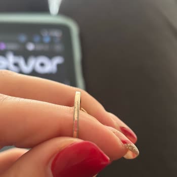 Kısa Sürede Deforme Olan Yüzüğe Mağaza İlgisizliği Ve Çözüm Sunulmaması