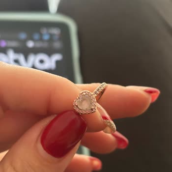 Kısa Sürede Deforme Olan Yüzüğe Mağaza İlgisizliği Ve Çözüm Sunulmaması