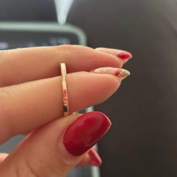 Kısa Sürede Deforme Olan Yüzüğe Mağaza İlgisizliği Ve Çözüm Sunulmaması