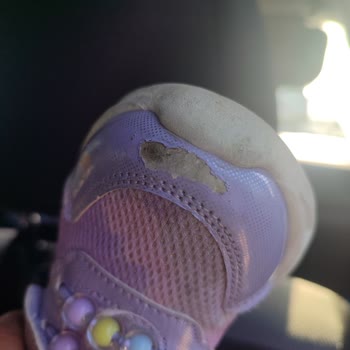 Çocuk Ayakkabısında Hızlı Bozulma Ve Yetersiz Müşteri Desteği