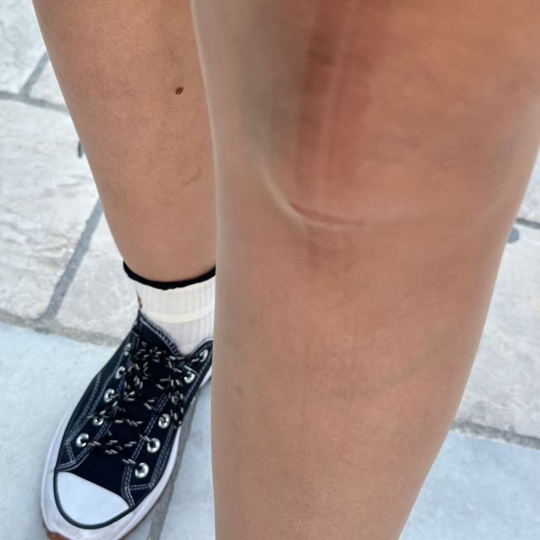 Penti Mağazasından Alınan Çorabın Kısa Sürede Yırtılması Ve İade Sorunu