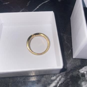 Pandora Yüzükte Renk Atması Ve Yetersiz İnceleme Süreci