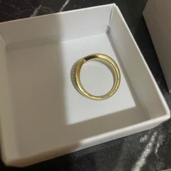 Pandora Yüzükte Renk Atması Ve Yetersiz İnceleme Süreci