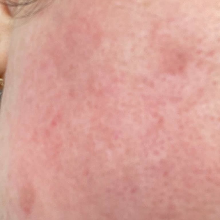 Bee Beauty Ürünleri Cildimi Mahvetti, Gratis İlgilenmiyor