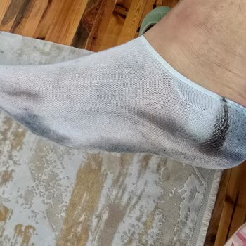 İlk Kullanımda Çorapları Boyayan Ayakkabı: Ayıplı Ürün Ve İade Talebi