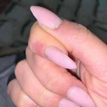 Bakım Hizmetlerinde Düzensizlik Ve İlgisizlik