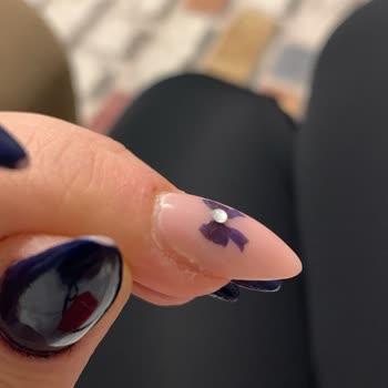 Bakım Hizmetlerinde Düzensizlik Ve İlgisizlik