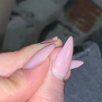 Bakım Hizmetlerinde Düzensizlik Ve İlgisizlik