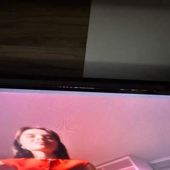 Onvo TV'de Ekran Ve Kumanda Sorunları, Yetersiz Servis Deneyimi
