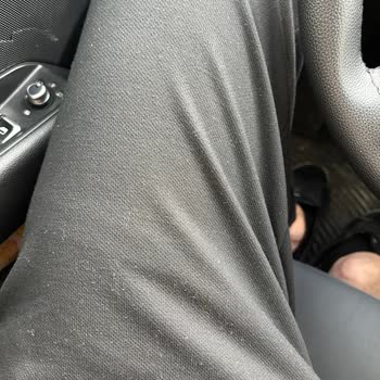 Bir Ayda Tüylenip Değişen Kalitesiz Ürün Hayal Kırıklığı