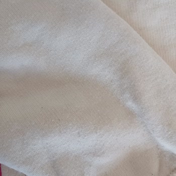 Zara'dan Gelen Takım Hızla Deforme Oldu, Müşteri Hizmetleri Cevap Vermiyor