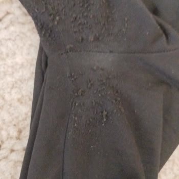 Eşofman Altında Kumaş Sorununa Anlamsız Cevap