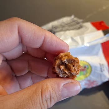 Mutfağım Patates'ten Yabancı Cisim Çıktı!