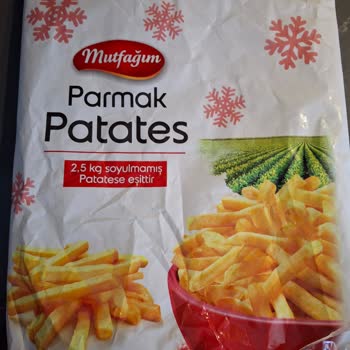 Mutfağım Patates'ten Yabancı Cisim Çıktı!