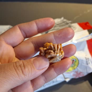 Mutfağım Patates'ten Yabancı Cisim Çıktı!