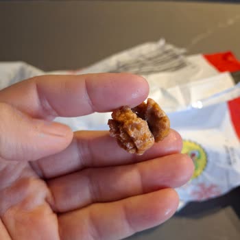 Mutfağım Patates'ten Yabancı Cisim Çıktı!